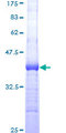 RAD54L Protein - 12.5% SDS-PAGE Stained with Coomassie Blue.