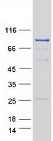 RAD54L Protein - Purified recombinant protein RAD54L was analyzed by SDS-PAGE gel and Coomassie Blue Staining