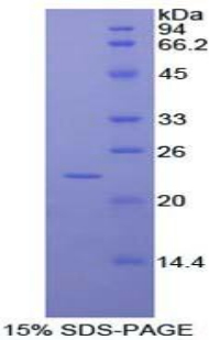 RAD54L2 Protein - Recombinant RAD54 Like Protein 2 By SDS-PAGE