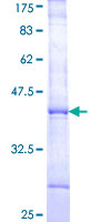 RAD9A / RAD9 Protein - 12.5% SDS-PAGE Stained with Coomassie Blue.