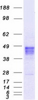 RAD9A / RAD9 Protein - Purified recombinant protein RAD9A was analyzed by SDS-PAGE gel and Coomassie Blue Staining