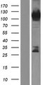 Radil Protein - Western validation with an anti-DDK antibody * L: Control HEK293 lysate R: Over-expression lysate