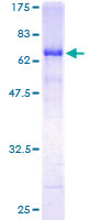 RADIL Protein - 12.5% SDS-PAGE of human FLJ10324 stained with Coomassie Blue