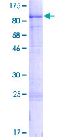 RAF1 / RAF Protein - 12.5% SDS-PAGE of human RAF1 stained with Coomassie Blue