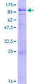 RAG2 / RAG-2 Protein - 12.5% SDS-PAGE of human RAG2 stained with Coomassie Blue
