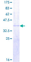 RAG2 / RAG-2 Protein - 12.5% SDS-PAGE Stained with Coomassie Blue.