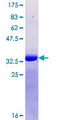 RAI1 Protein - 12.5% SDS-PAGE Stained with Coomassie Blue.