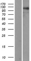 RAI14 Protein - Western validation with an anti-DDK antibody * L: Control HEK293 lysate R: Over-expression lysate
