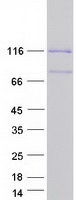RAI14 Protein - Purified recombinant protein RAI14 was analyzed by SDS-PAGE gel and Coomassie Blue Staining