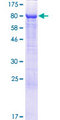 RAI2 Protein - 12.5% SDS-PAGE of human RAI2 stained with Coomassie Blue