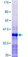 RAI2 Protein - 12.5% SDS-PAGE Stained with Coomassie Blue.