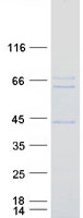 RAI2 Protein - Purified recombinant protein RAI2 was analyzed by SDS-PAGE gel and Coomassie Blue Staining