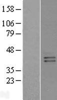 RAIG2 / GPRC5B Protein - Western validation with an anti-DDK antibody * L: Control HEK293 lysate R: Over-expression lysate