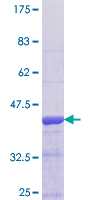 RAIG2 / GPRC5B Protein - 12.5% SDS-PAGE Stained with Coomassie Blue