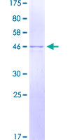 RALA / RAL Protein - 12.5% SDS-PAGE of human RALA stained with Coomassie Blue