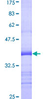 RALA / RAL Protein - 12.5% SDS-PAGE Stained with Coomassie Blue.