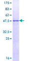 RALB Protein - 12.5% SDS-PAGE of human RALB stained with Coomassie Blue