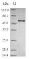 RALB Protein - (Tris-Glycine gel) Discontinuous SDS-PAGE (reduced) with 5% enrichment gel and 15% separation gel.