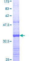 RALB Protein - 12.5% SDS-PAGE Stained with Coomassie Blue.