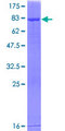 RALDH2 / ALDH1A2 Protein - 12.5% SDS-PAGE of human ALDH1A2 stained with Coomassie Blue