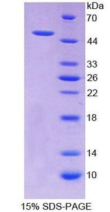 RALDH2 / ALDH1A2 Protein - Recombinant  Aldehyde Dehydrogenase 1 Family, Member A2 By SDS-PAGE