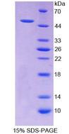 RALDH2 / ALDH1A2 Protein - Recombinant  Aldehyde Dehydrogenase 1 Family, Member A2 By SDS-PAGE