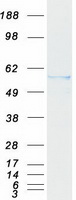 RALDH2 / ALDH1A2 Protein - Purified recombinant protein ALDH1A2 was analyzed by SDS-PAGE gel and Coomassie Blue Staining