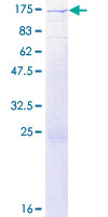 RALGDS Protein - 12.5% SDS-PAGE of human RALGDS stained with Coomassie Blue