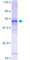 RALGPS1 Protein - 12.5% SDS-PAGE of human RALGPS1 stained with Coomassie Blue