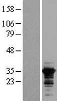 RALY Protein - Western validation with an anti-DDK antibody * L: Control HEK293 lysate R: Over-expression lysate