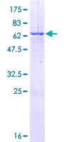 RALYL Protein - 12.5% SDS-PAGE of human RALYL stained with Coomassie Blue