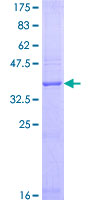 RAMP1 Protein - 12.5% SDS-PAGE of human RAMP1 stained with Coomassie Blue