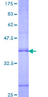 RAMP2 Protein - 12.5% SDS-PAGE Stained with Coomassie Blue.