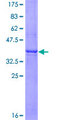RAMP3 Protein - 12.5% SDS-PAGE of human RAMP3 stained with Coomassie Blue