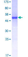 RAN Protein - 12.5% SDS-PAGE of human RAN stained with Coomassie Blue