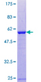 RAN Protein - 12.5% SDS-PAGE of human RAN stained with Coomassie Blue