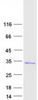 RAN Protein - Purified recombinant protein RAN was analyzed by SDS-PAGE gel and Coomassie Blue Staining