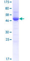 RANBP1 Protein - 12.5% SDS-PAGE of human RANBP1 stained with Coomassie Blue