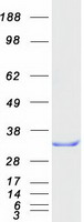 RANBP1 Protein - Purified recombinant protein RANBP1 was analyzed by SDS-PAGE gel and Coomassie Blue Staining