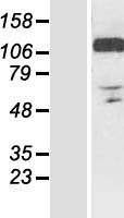 RANBP10 Protein - Western validation with an anti-DDK antibody * L: Control HEK293 lysate R: Over-expression lysate