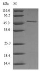 RANBP2 / TRP1 Protein - (Tris-Glycine gel) Discontinuous SDS-PAGE (reduced) with 5% enrichment gel and 15% separation gel.