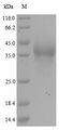 RANBP2 / TRP1 Protein - (Tris-Glycine gel) Discontinuous SDS-PAGE (reduced) with 5% enrichment gel and 15% separation gel.