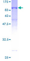 RANGAP1 Protein - 12.5% SDS-PAGE of human RANGAP1 stained with Coomassie Blue