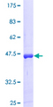 RAP1B Protein - 12.5% SDS-PAGE of human RAP1B stained with Coomassie Blue