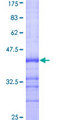RAP1B Protein - 12.5% SDS-PAGE Stained with Coomassie Blue.