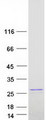 RAP1B Protein - Purified recombinant protein RAP1B was analyzed by SDS-PAGE gel and Coomassie Blue Staining