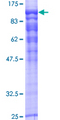 RAP1GAP Protein - 12.5% SDS-PAGE of human RAP1GA1 stained with Coomassie Blue