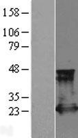 RAP2 Protein - Western validation with an anti-DDK antibody * L: Control HEK293 lysate R: Over-expression lysate