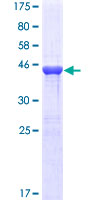 RAP2B Protein - 12.5% SDS-PAGE of human RAP2B stained with Coomassie Blue