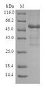 RAP2B Protein - (Tris-Glycine gel) Discontinuous SDS-PAGE (reduced) with 5% enrichment gel and 15% separation gel.